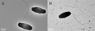 Transcriptome analysis of the hepatopancreas from the Litopenaeus vannamei infected with different flagellum types of Vibrio alginolyticus strains